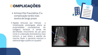 Rigidez Articular por Fibrose: a
imobilização prolongada altera as
propriedades viscoelásticas do
colágeno tecidual. A perda da
dorsiflexão (movimento do pé para
cima) é a alteração biomecânica mais
comum, o que altera o padrão da
marcha (fazer o paciente mancar) e
sobrecarrega o joelho e o quadril.
COMPLICAÇÕES
Artrose Pós-Traumática: É a
complicação tardia mais
severa de longo prazo.
 