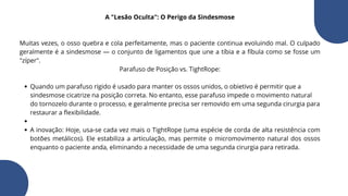A "Lesão Oculta": O Perigo da Sindesmose
Muitas vezes, o osso quebra e cola perfeitamente, mas o paciente continua evoluindo mal. O culpado
geralmente é a sindesmose — o conjunto de ligamentos que une a tíbia e a fíbula como se fosse um
"zíper".
Parafuso de Posição vs. TightRope:
Quando um parafuso rigido é usado para manter os ossos unidos, o obietivo é permitir que a
sindesmose cicatrize na posição correta. No entanto, esse parafuso impede o movimento natural
do tornozelo durante o processo, e geralmente precisa ser removido em uma segunda cirurgia para
restaurar a flexibilidade.
A inovação: Hoje, usa-se cada vez mais o TightRope (uma espécie de corda de alta resistência com
botões metálicos). Ele estabiliza a articulação, mas permite o micromovimento natural dos ossos
enquanto o paciente anda, eliminando a necessidade de uma segunda cirurgia para retirada.
 