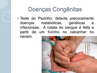 Doenças Congênitas 
 Teste do Pezinho: detecta precocemente 
doenças metabólicas, genéticas e 
infecciosas. A coleta do sangue é feita a 
partir de um furinho no calcanhar no 
neném. 
 