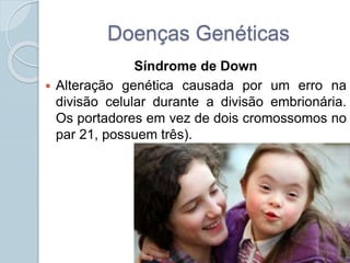 Doenças Genéticas 
Síndrome de Down 
 Alteração genética causada por um erro na 
divisão celular durante a divisão embrionária. 
Os portadores em vez de dois cromossomos no 
par 21, possuem três). 
 