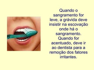 Quando o sangramento for leve, a grávida deve insistir   na escovação onde há o sangramento. Quando for acentuado, deve ir ao dentista para a remoção dos fatores irritantes . 