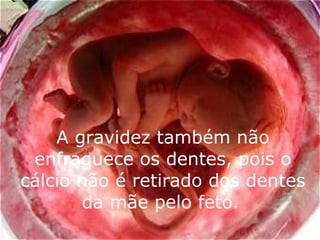 A gravidez também não enfraquece os dentes, pois o cálcio não é retirado dos dentes da mãe pelo feto.   