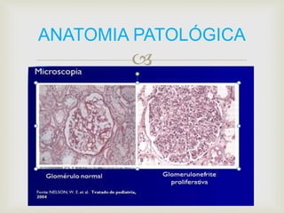 ANATOMIA PATOLÓGICA 
 
 