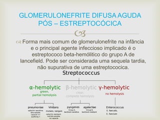 GLOMERULONEFRITE DIFUSA AGUDA 
PÓS – ESTREPTOCÓCICA 
 
 Forma mais comum de glomerulonefrite na infância 
e o principal agente infeccioso implicado é o 
estreptococo beta-hemólitico do grupo A de 
lancefield. Pode ser considerada uma sequela tardia, 
não supurativa de uma estreptococica. 
 