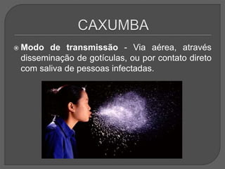  Modo de transmissão - Via aérea, através
disseminação de gotículas, ou por contato direto
com saliva de pessoas infectadas.
 