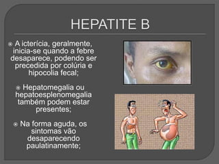  A icterícia, geralmente,
inicia-se quando a febre
desaparece, podendo ser
precedida por colúria e
hipocolia fecal;
 Hepatomegalia ou
hepatoesplenomegalia
também podem estar
presentes;
 Na forma aguda, os
sintomas vão
desaparecendo
paulatinamente;
 