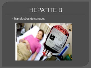  Transfusões de sangue;
 