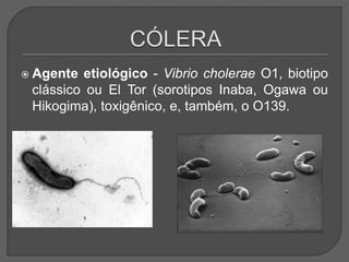  Agente etiológico - Vibrio cholerae O1, biotipo
clássico ou El Tor (sorotipos Inaba, Ogawa ou
Hikogima), toxigênico, e, também, o O139.
 