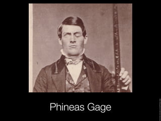 Phineas Gage



Image:http://www.ask.com/wiki/Phineas_Gage
 