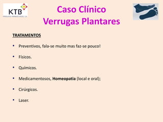 Caso Clínico
Verrugas Plantares
TRATAMENTOS
• Preventivos, fala-se muito mas faz-se pouco!
• Físicos.
• Químicos.
• Medicamentosos, Homeopatia (local e oral);
• Cirúrgicos.
• Laser.
 