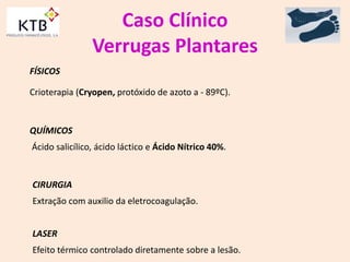 Caso Clínico
Verrugas Plantares
FÍSICOS
Crioterapia (Cryopen, protóxido de azoto a - 89ºC).
QUÍMICOS
Ácido salicílico, ácido láctico e Ácido Nítrico 40%.
CIRURGIA
Extração com auxilio da eletrocoagulação.
LASER
Efeito térmico controlado diretamente sobre a lesão.
 