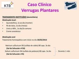 Caso Clínico
Verrugas Plantares
TRATAMENTO INSTITUÍDO (domiciliário)
Medicação local:
• Queratolítico, 1x ao dia (manter)
• Pó de talco, 1x dia (meias)
• Ureia a 40% , 1x dia/2x semana
• Creme anestésico
Medicação oral:
Tratamento homeopático com início no dia 20/02/2013
Natrium sulfuricum D6 (sulfato de sódio) 80 caps. 3x dia
(Sal de Schussler nº10)
Kalium sulfuricum D6 (sulfato de potássio) 80 caps. 3x dia Durante 1 mês
(Sal de Schussler nº6)
 