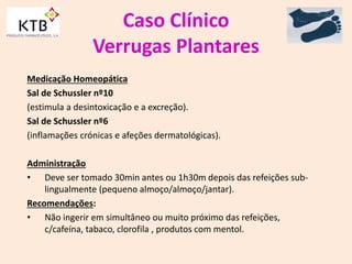 Caso Clínico
Verrugas Plantares
Medicação Homeopática
Sal de Schussler nº10
(estimula a desintoxicação e a excreção).
Sal de Schussler nº6
(inflamações crónicas e afeções dermatológicas).
Administração
• Deve ser tomado 30min antes ou 1h30m depois das refeições sub-
lingualmente (pequeno almoço/almoço/jantar).
Recomendações:
• Não ingerir em simultâneo ou muito próximo das refeições,
c/cafeína, tabaco, clorofila , produtos com mentol.
 