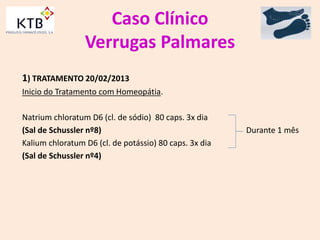 Caso Clínico
Verrugas Palmares
1) TRATAMENTO 20/02/2013
Inicio do Tratamento com Homeopátia.
Natrium chloratum D6 (cl. de sódio) 80 caps. 3x dia
(Sal de Schussler nº8) Durante 1 mês
Kalium chloratum D6 (cl. de potássio) 80 caps. 3x dia
(Sal de Schussler nº4)
 