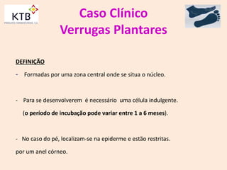 Caso Clínico
Verrugas Plantares
DEFINIÇÃO
- Formadas por uma zona central onde se situa o núcleo.
- Para se desenvolverem é necessário uma célula indulgente.
(o período de incubação pode variar entre 1 a 6 meses).
- No caso do pé, localizam-se na epiderme e estão restritas.
por um anel córneo.
 