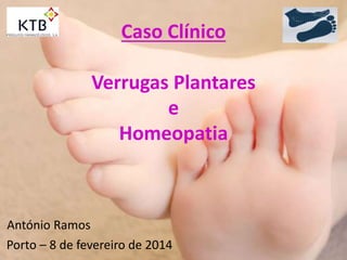 Caso Clínico
Verrugas Plantares
e
Homeopatia
António Ramos
Porto – 8 de fevereiro de 2014
 