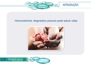 INTRODUÇÃO
Homocistinúria: diagnóstico precoce pode salvar vidas
 