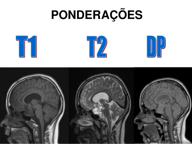 RESSONÂNCIA MAGNÉTICA-ATUALIZAÇÃO