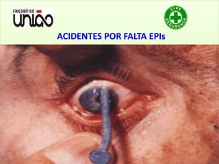 ACIDENTES POR FALTA EPIs
 