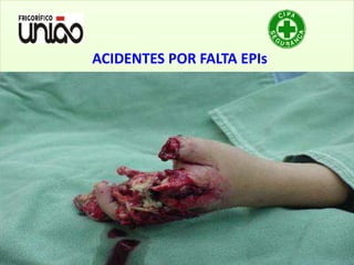 ACIDENTES POR FALTA EPIs
 
