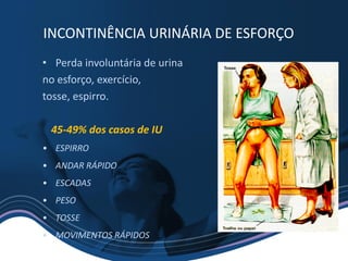 • Perda involuntária de urina
no esforço, exercício,
tosse, espirro.
45-49% dos casos de IU
• ESPIRRO
• ANDAR RÁPIDO
• ESCADAS
• PESO
• TOSSE
• MOVIMENTOS RÁPIDOS
INCONTINÊNCIA URINÁRIA DE ESFORÇO
 