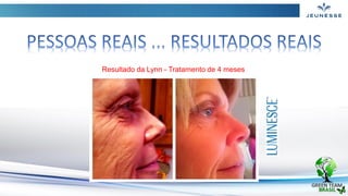 Resultado da Lynn - Tratamento de 4 meses
 
