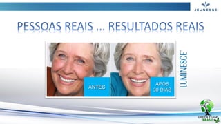 ANTES
APÓS
30 DIAS
 