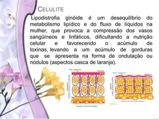 CELULITE
Lipodistrofia ginóide é um desequilíbrio do
metabolismo lipídico e do fluxo de líquidos na
mulher, que provoca a compressão dos vasos
sangüíneos e linfáticos, dificultando a nutrição
celular e favorecendo o acúmulo de
toxinas, levando a um acúmulo de gorduras
que se apresenta na forma de ondulação ou
nódulos (aspectos casca de laranja).
 