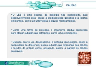 • O LES é uma doença de etiologia não esclarecida. Seu
desenvolvimento está ligado à predisposição genética e a fatores
ambientais, como luz ultravioleta e alguns medicamentos.
• Como uma forma de proteção, o organismo produz anticorpos
para atacar substâncias estranhas, como vírus e bactérias.
• Quando ocorre um desequilíbrio, o sistema imunológico perde a
capacidade de diferenciar essas substâncias estranhas das células
e tecidos do próprio corpo, passando, assim, a agredir as células
saudáveis.
CAUSAS
 