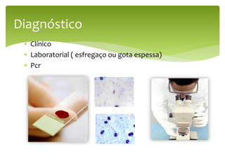  Clínico
 Laboratorial ( esfregaço ou gota espessa)
 Pcr
Diagnóstico
 