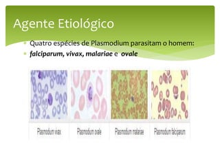  Quatro espécies de Plasmodium parasitam o homem:
 falciparum, vivax, malariae e ovale
Agente Etiológico
 