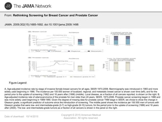 Date of download: 10/14/2015
Copyright © 2015 American Medical
Association. All rights reserved.
From: Rethinking Screening for Breast Cancer and Prostate Cancer
JAMA. 2009;302(15):1685-1692. doi:10.1001/jama.2009.1498
A, Age-adjusted incidence rate by stage of invasive female breast cancers for all ages, SEER 1973-2006. Mammography was introduced in 1983 and more
widely used beginning in 1986. The incidence per 100 000 women of localized, regional, and metastatic breast cancer is shown over time (left), and for the
period prior to the uptake of screening (1982) and 16 years after (1998) (middle). Local disease, as a fraction of all cancers reported, is shown on the right. B,
Age-adjusted incidence rate of adenocarcinoma of the prostate for men older than 24 years, SEER, 1973-2006. Prostate cancer screening began in 1986 and
was more widely used beginning in 1989-1990. Given the degree of missing data for prostate cancer TNM stage in SEER, we chose to show the change in
Gleason grade, a significant predictor of outcome since the introduction of screening. The middle panel shows the incidence per 100 000 men of tumors with
Gleason grades that were low- and intermediate-grade (2-7) vs high-grade (8-10) tumors, for the period prior to the uptake of screening (1988) and 16 years
after (2004). The low- and intermediate-grade tumors as a fraction of all cancers is shown in the panel on the right.
Figure Legend:
 