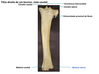 Tíbia direita de um bovino; vista caudal Extremidade proximal da fíbula Côndilo lateral Eminência intercondilar Côndilo medial Maléolo medial Maléolo lateral 