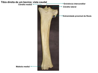 Tíbia direita de um bovino; vista caudal Extremidade proximal da fíbula Côndilo lateral Eminência intercondilar Côndilo medial Maléolo medial 