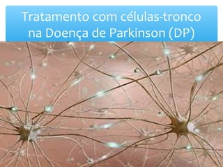 Tratamento com células-tronco
na Doença de Parkinson (DP)
 