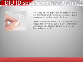 Consiste em um dispositivo de cobre ou o DIU com hormônio(um tipo de progesterona), que é colocado pelo médico dentro do útero; Esse dispositivo impede que o espermatozóide chegue até o óvulo ou que o óvulo, já fertilizado, se implante nas paredes do útero e o feto se desenvolva no bebê. 