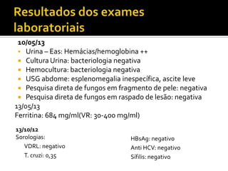 13/10/12
Sorologias:
VDRL: negativo
T. cruzi: 0,35
HBsAg: negativo
Anti HCV: negativo
Sífilis: negativo
10/05/13
 Urina – Eas: Hemácias/hemoglobina ++
 Cultura Urina: bacteriologia negativa
 Hemocultura: bacteriologia negativa
 USG abdome: esplenomegalia inespecífica, ascite leve
 Pesquisa direta de fungos em fragmento de pele: negativa
 Pesquisa direta de fungos em raspado de lesão: negativa
13/05/13
Ferritina: 684 mg/ml(VR: 30-400 mg/ml)
 