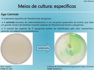 Compreendendo o Staphylococcus Aureus: Uma infecção bacteriana comum - GENE  MEIDIKE