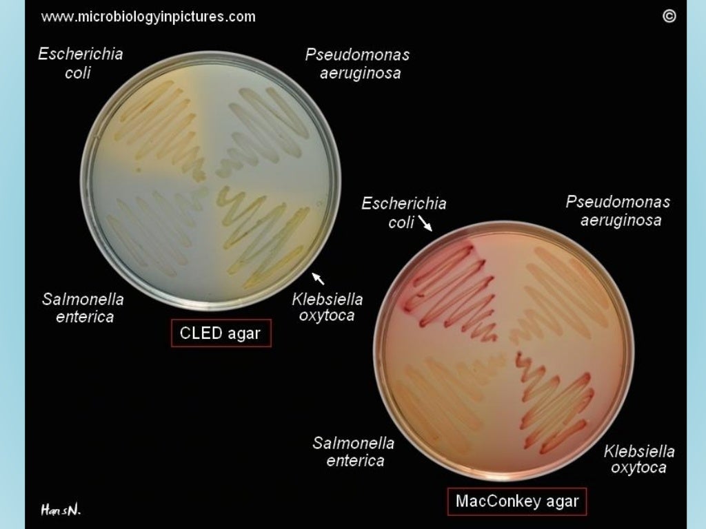 Microbiologia meios de cultura e provas de identificação Microbiologia meios de cultura e provas de identificação