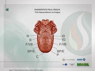 DIAGNÓSTICO PELA LÍNGUA
Três Aquecedores na Língua
Figura 27: Representação do Zang Fú no Micro Sistema da Língua
 