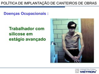 Doenças Ocupacionais :
Trabalhador com
silicose em
estágio avançado
POLÍTICA DE IMPLANTAÇÃO DE CANTEIROS DE OBRAS
 