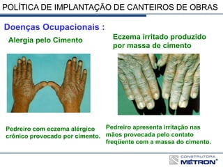 Alergia pelo Cimento Eczema irritado produzido
por massa de cimento
Pedreiro com eczema alérgico
crônico provocado por cimento.
Pedreiro apresenta irritação nas
mãos provocada pelo contato
freqüente com a massa do cimento.
Doenças Ocupacionais :
POLÍTICA DE IMPLANTAÇÃO DE CANTEIROS DE OBRAS
 