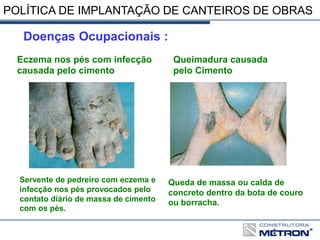 POLÍTICA DE IMPLANTAÇÃO DE CANTEIROS DE OBRAS
Doenças Ocupacionais :
Eczema nos pés com infecção
causada pelo cimento
Queimadura causada
pelo Cimento
Servente de pedreiro com eczema e
infecção nos pés provocados pelo
contato diário de massa de cimento
com os pés.
Queda de massa ou calda de
concreto dentro da bota de couro
ou borracha.
 