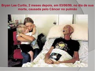 Bryan Lee Curtis, 2 meses depois, em 03/06/99, no dia de sua
morte, causada pelo Câncer no pulmão
 