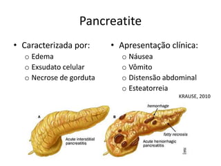 Pancreatite
• Caracterizada por:
o Edema
o Exsudato celular
o Necrose de gorduta
• Apresentação clínica:
o Náusea
o Vômito
o Distensão abdominal
o Esteatorreia
KRAUSE, 2010
 