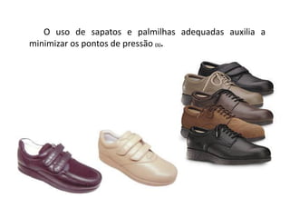 O uso de sapatos e palmilhas adequadas auxilia a
minimizar os pontos de pressão (1).
 