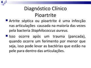 Diagnóstico Clínico
Pioartrite

Artrite séptica ou pioartrite é uma infecção
nas articulações causada na maioria das vezes
pela bacteria Staphilococcus aureus.
 Isso ocorre após um trauma (pancada),
quando ocorre um ferimento por menor que
seja, isso pode levar as bactérias que estão na
pele para dentro das articulações.


 