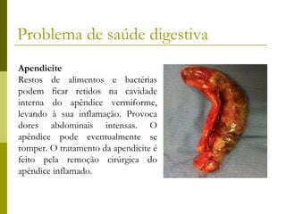 Problema de saúde digestiva
Apendicite
Restos de alimentos e bactérias
podem ficar retidos na cavidade
interna do apêndice vermiforme,
levando à sua inflamação. Provoca
dores abdominais intensas. O
apêndice pode eventualmente se
romper. O tratamento da apendicite é
feito pela remoção cirúrgica do
apêndice inflamado.

 