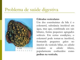 Problema de saúde digestiva
Cálculos vesiculares
Um dos constituintes da bile é o
colesterol, substância insolúvel em
água, mas que, combinada aos sais
biliares, forma pequenos agregados
solúveis. Em certas condições, o
colesterol pode tornar-se insolúvel,
formando pequenos grãos no
interior da vesícula biliar, os cálculos
vesiculares
ou
cálculos
biliares,
popularmente conhecidos como
pedras na vesícula.

 