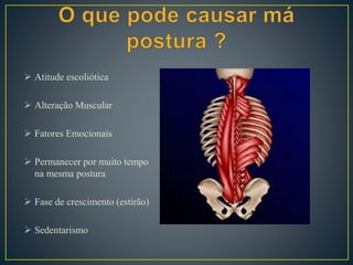  Atitude escoliótica
 Alteração Muscular
 Fatores Emocionais
 Permanecer por muito tempo
na mesma postura
 Fase de crescimento (estirão)
 Sedentarismo
 